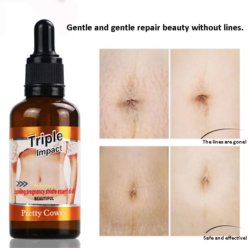 Pretty Cowry Maternity Skin Care Anti Scar Stretch Marks Removal Oil