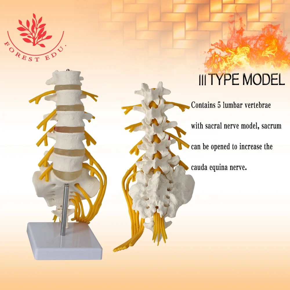 Поясничная модель 5 штук позвонков косточки нервных корешков и с правой стороны крестцового нерва седалищного филиал обучающие игрушки