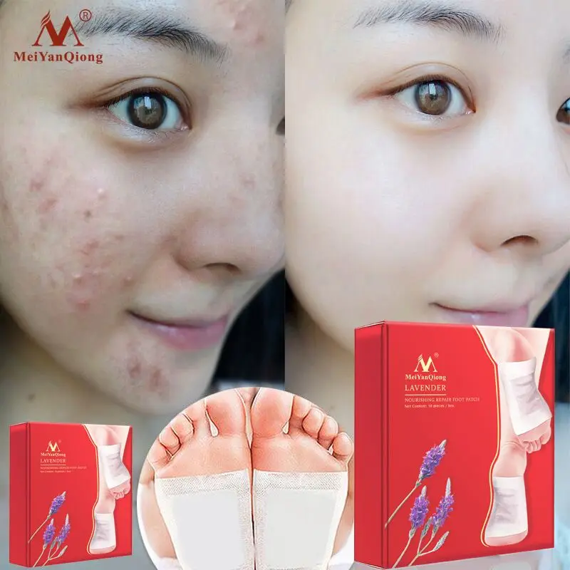 Detox Foot Pads Healthcare Supply Organic Herbal Cleansing Patches Healthy Slimming Foot Sticker