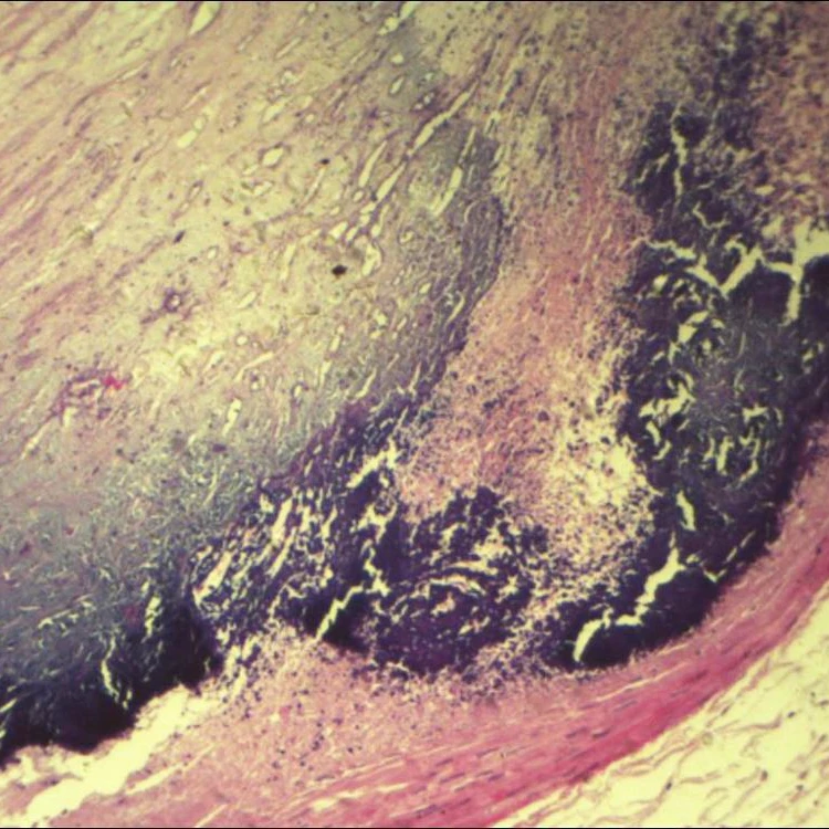 Fixed set High quality 50/100 pieces human general pathology prepared general pathology slides