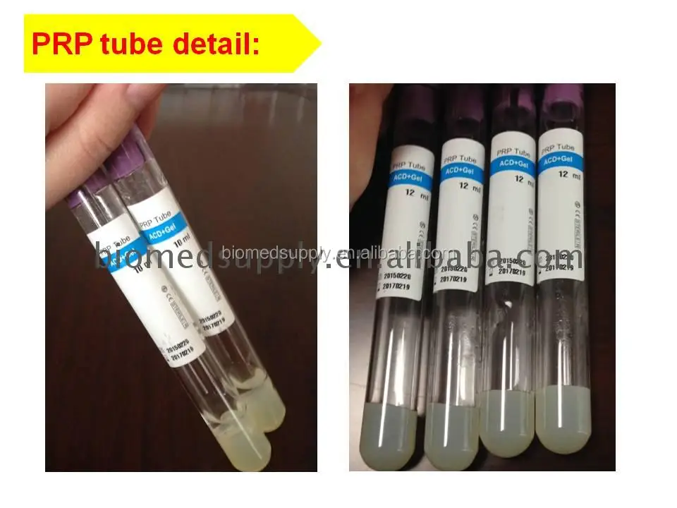BEMEDIKPRP CE Certified 15ml prp tube with sodium citrate with gel sodium citrate