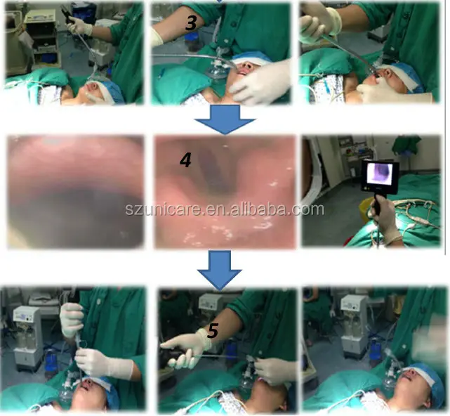 electronic video endoscope flexible fiber optic laryngoscope set