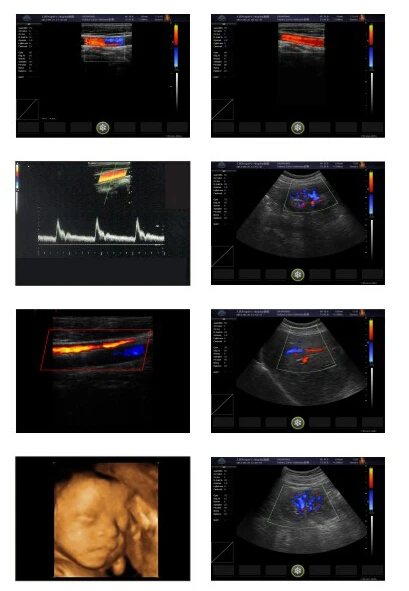 Аппарат USG по разумной цене Ультразвуковой доплеровский сканер 4D для продажи (MSLCU24)