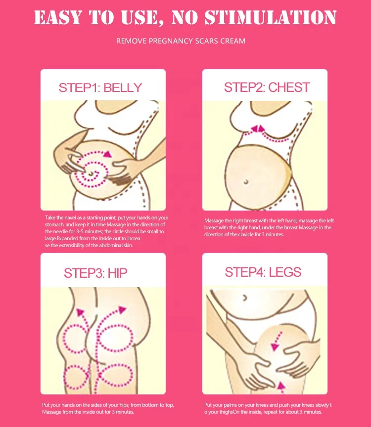 Water Ice Levin brand Herbal extract maternity skin repair remove Pregnancy Stretch Marks Scars Essential oil