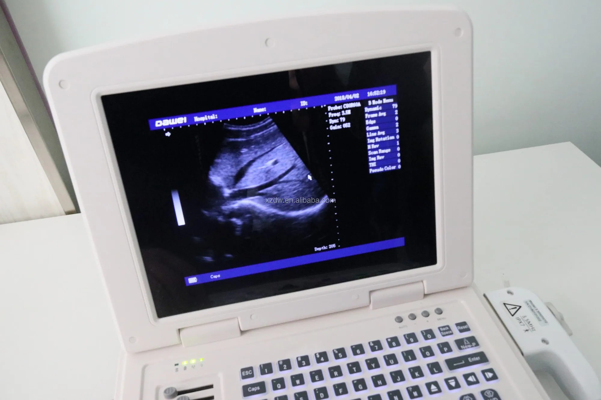 laptop ultrasound machine& cheap BW ultrasound scanner with battery DW580