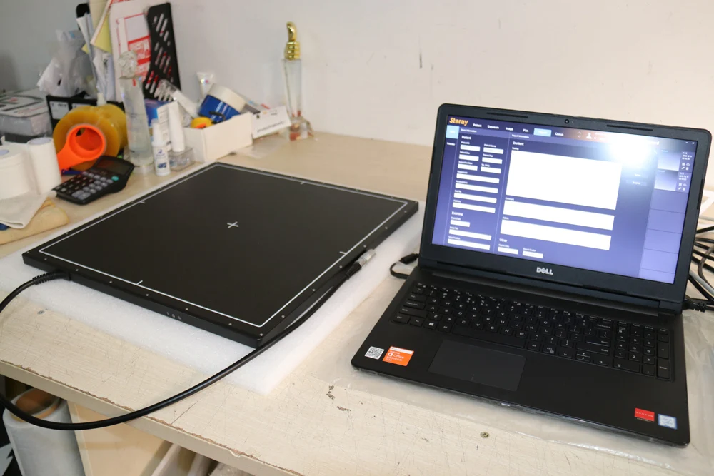 radiology flat panel digital portable x-ray machine