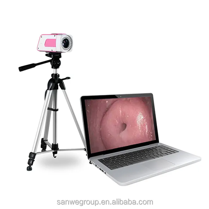 SW-3301 портативный видеокольпоскоп/влагалища кольпоскоп с камеры высокого разрешения
