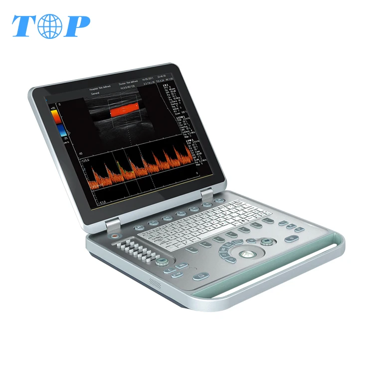 TOP-A1055 Best Scanner High Pulse Repetition Frequency Laptop Equipment Price/Medical 3d Color Doppler Ultrasound Scanner