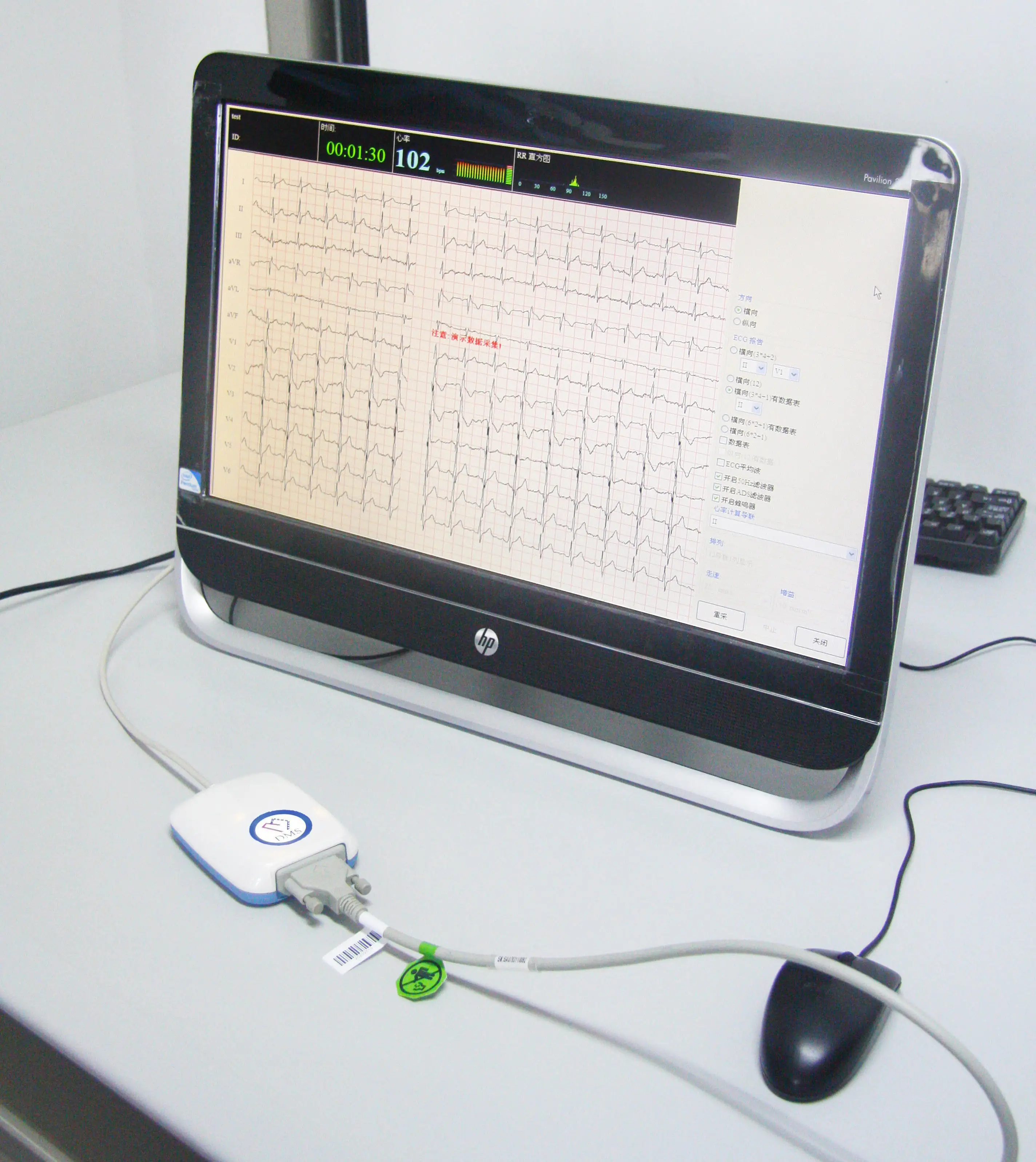 
Resting 12 channel Tablet PC Resting ECG 
