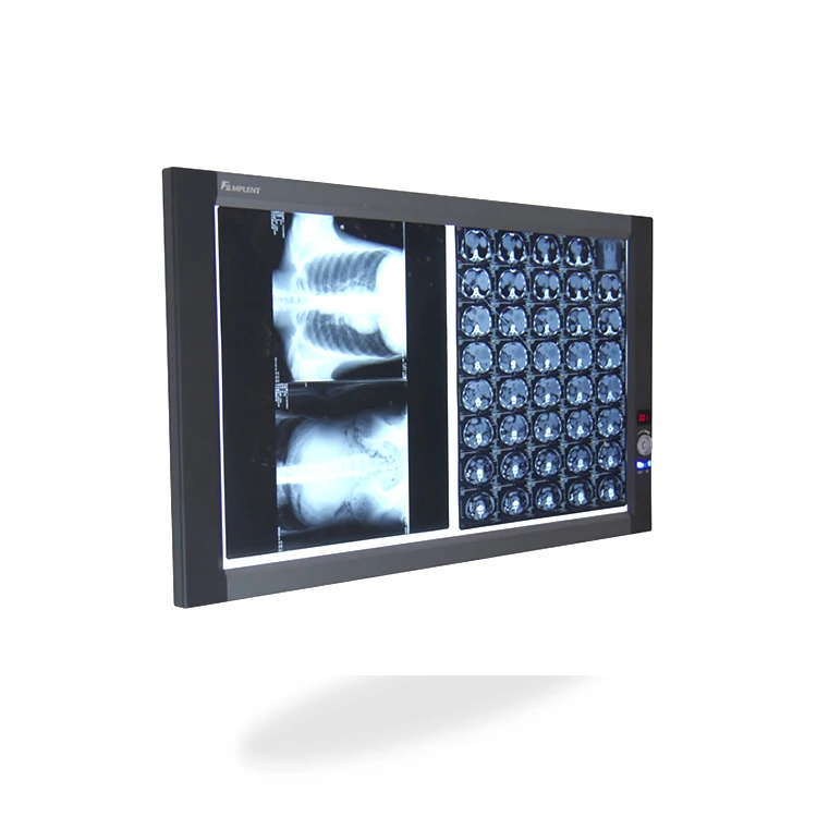 Mplent ultra slim x ray film digitizer led lights radiograph viewer