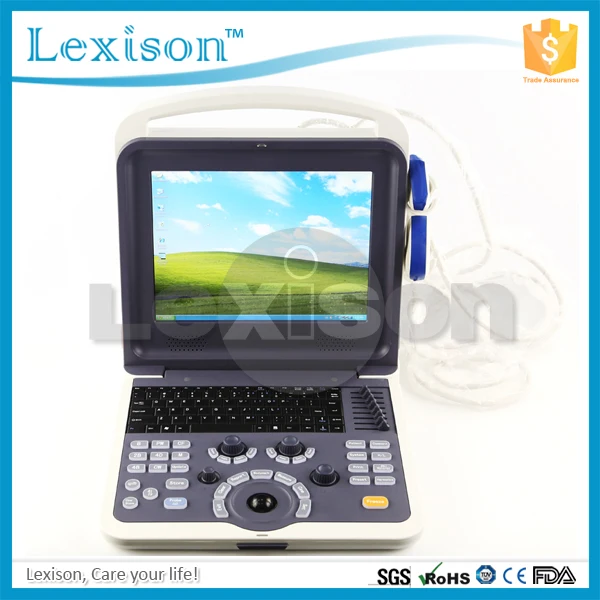 
Cardiac Portable Ultrasound 4D Ultrasound Scanner Color Doppler Ultrasound Machine Price 