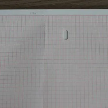 
High quality ECG paper 