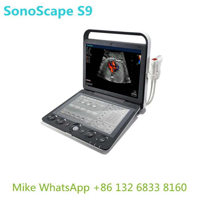  Ультразвуковой допплеровский сканер Sonoscape S9 уверенность в диагностике