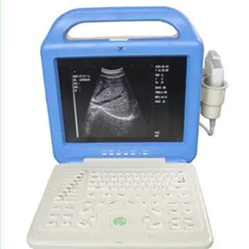Portable Echocardiography 2D/3D/4D Ultrasound Machine