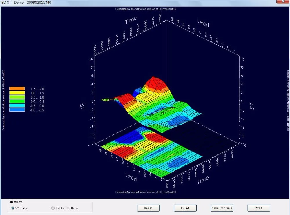 Promotion Product New Digital 3 Channel Holter ECG machine ECG Holter with CE certificate