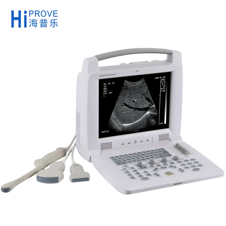 Черный/белый полностью цифровой портативный ультразвуковой сканер