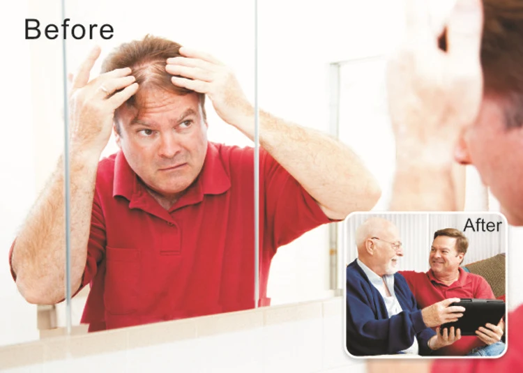 Топ производитель JIANYUAN бутылка волокно волоса спрей аппликатор скрыть выпадение волос