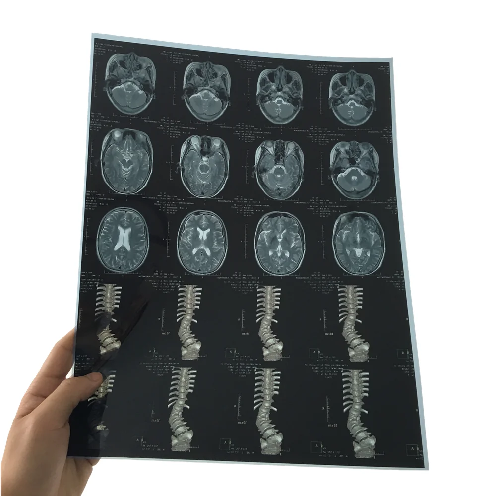 Waterproof Thermal  Printing Blue Sensitive Medical X-ray Film Same as agfa DT2B and DT5B 14x17