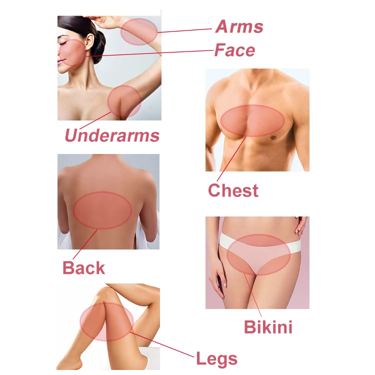 
OSANO professional 808nm painless hair removal machine laser 808 diode 