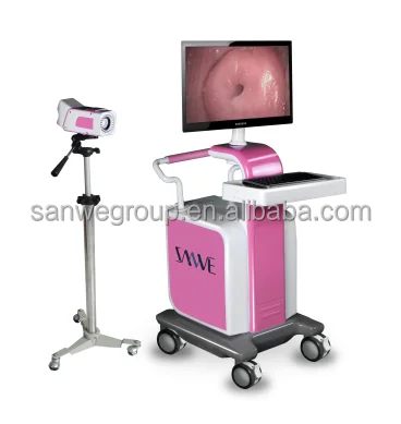 15 дюйм(ов) монитор LED цифровые электронные кольпоскоп с камеры sony