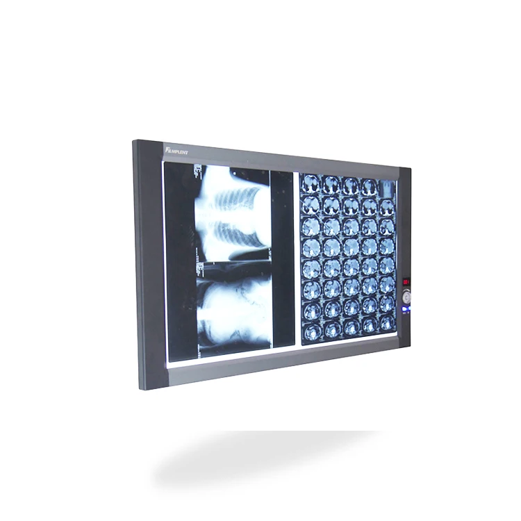 Mplent top sales ZG-2C smart led slim x-ray film viewer negatoscope X Ray illuminator with CE with ISO13485 factory