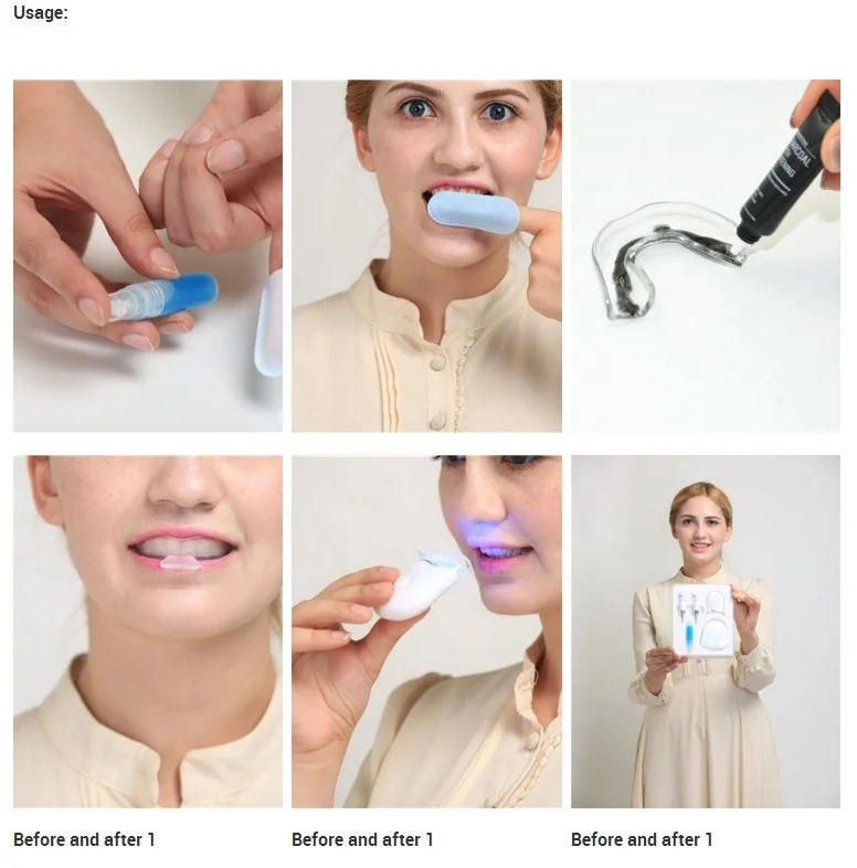 0.1%-35% Carbamide peroxide  whitening gel for teeth bleaching