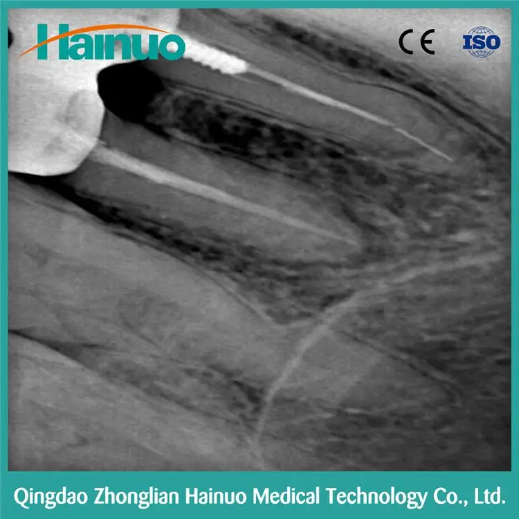 
Hot Sale HDR Intraoral Digital X-ray Radiologic Dental 