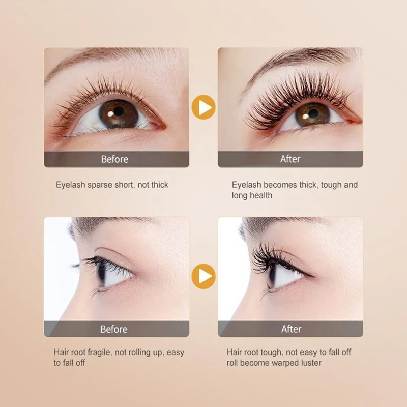 Травяное лечение для роста ресниц MeiYanQiong, жидкая сыворотка, лечение натуральных ресниц, удлинение ресниц