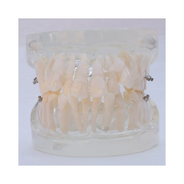 dental education orthodontic model