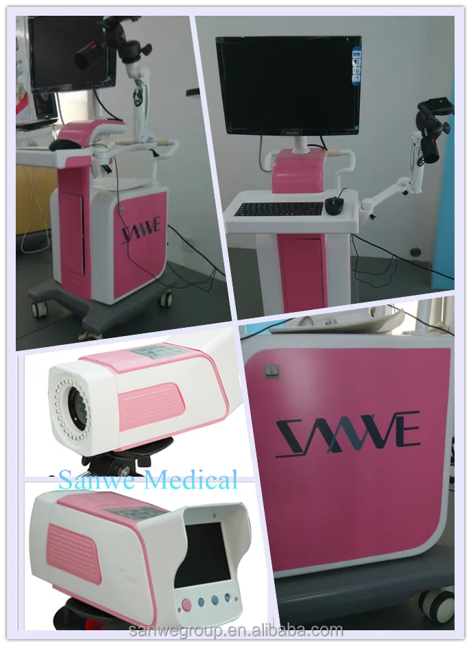 SW-3304 Digital Video Colposcope, Vaginal Colposcope with Camera, Video Colposcope