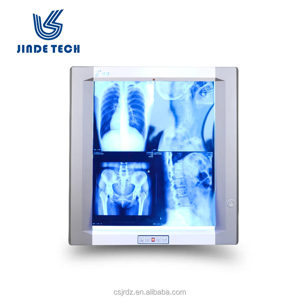 
Jinde JD 01AIII Single bank radiaography led film viewer X ray medical negatoscope film viewer 