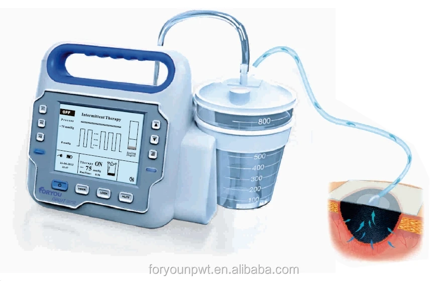 Закрытие раны всасывания терапии/вакуумным усилителем закрытия раны терапии острых и хронических ран
