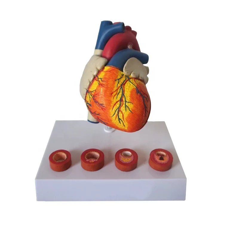 Atherosclerotic Model Heart Disease
