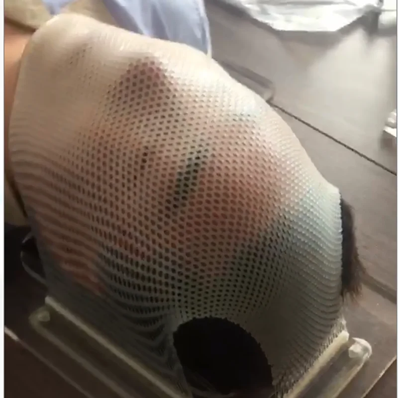 Маски для иммобилизации, маска для радиации МРТ, Термопластик для рака мозга