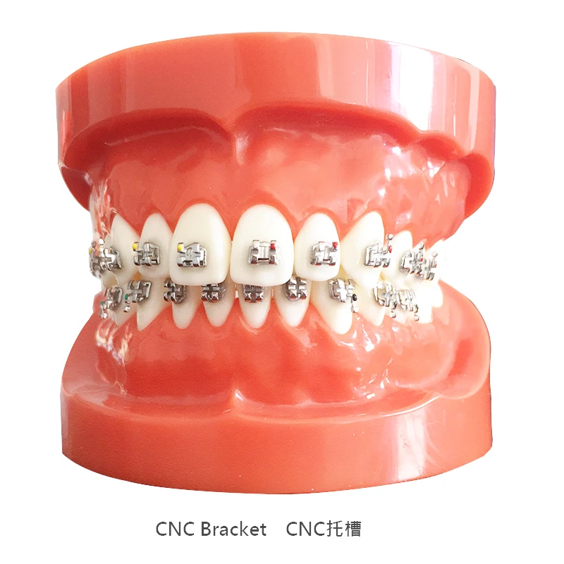 Dental Manufacturer Braces Mini Milling CNC Orthodontic Metal Dental Brackets