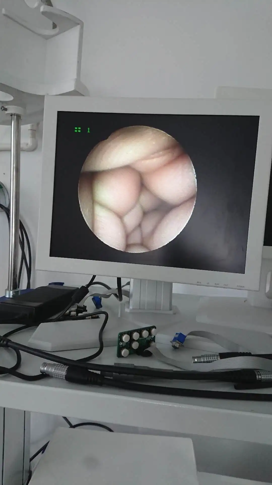 High quality cheap Fiber endoscope of gastroscope colonoscopy for sale