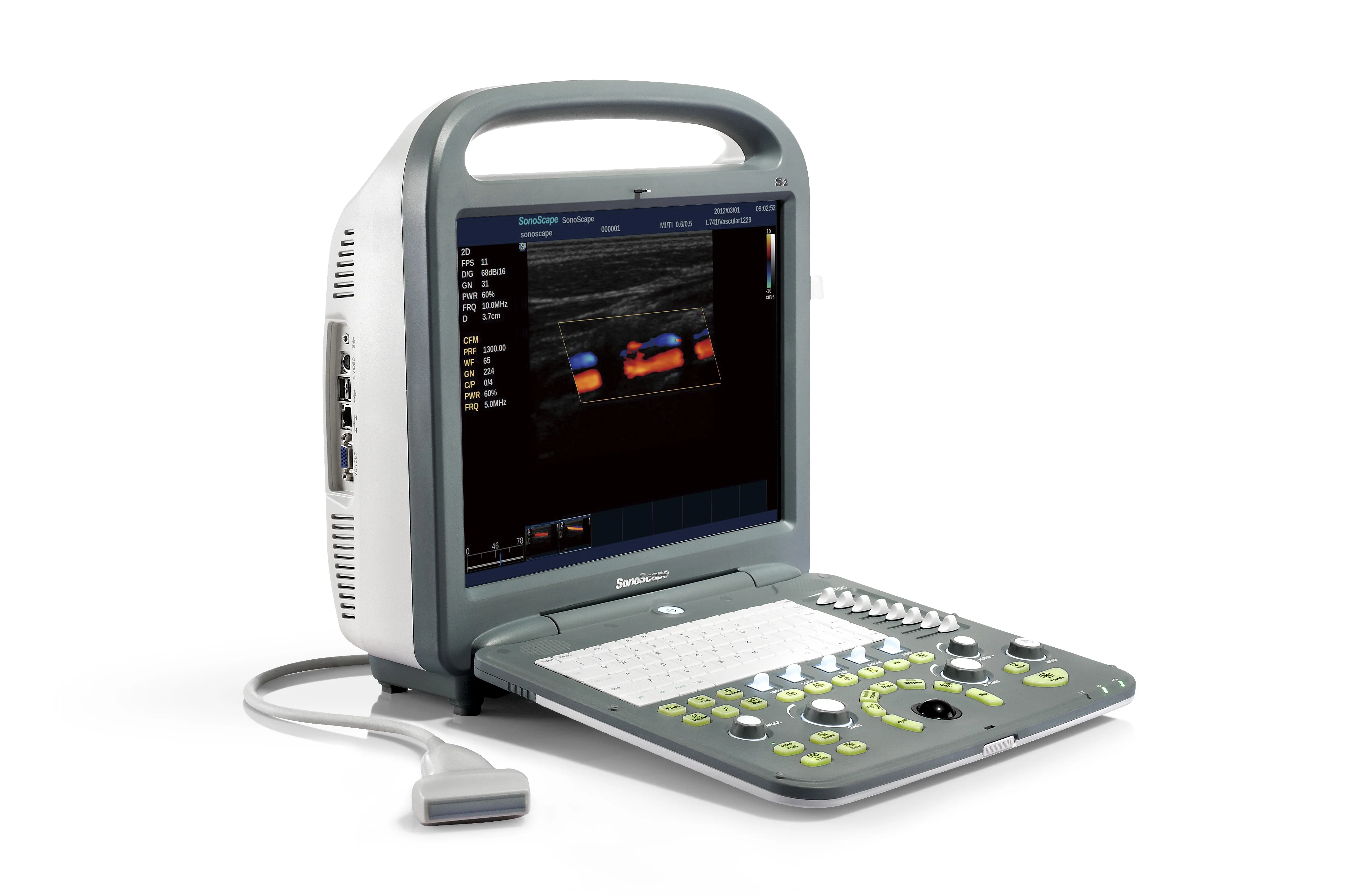 Famous color doppler ultrasound machine sonoscape p20 price