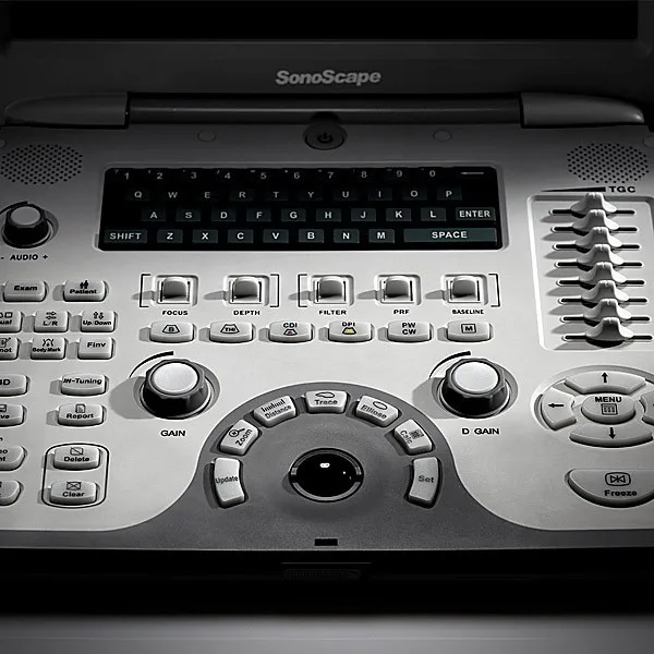Sonoscape S6V портативный 4D цветной Ветеринарный ультразвуковой собак кошек Лошадь 15 дюймов Высокое разрешение ЖК-монитор