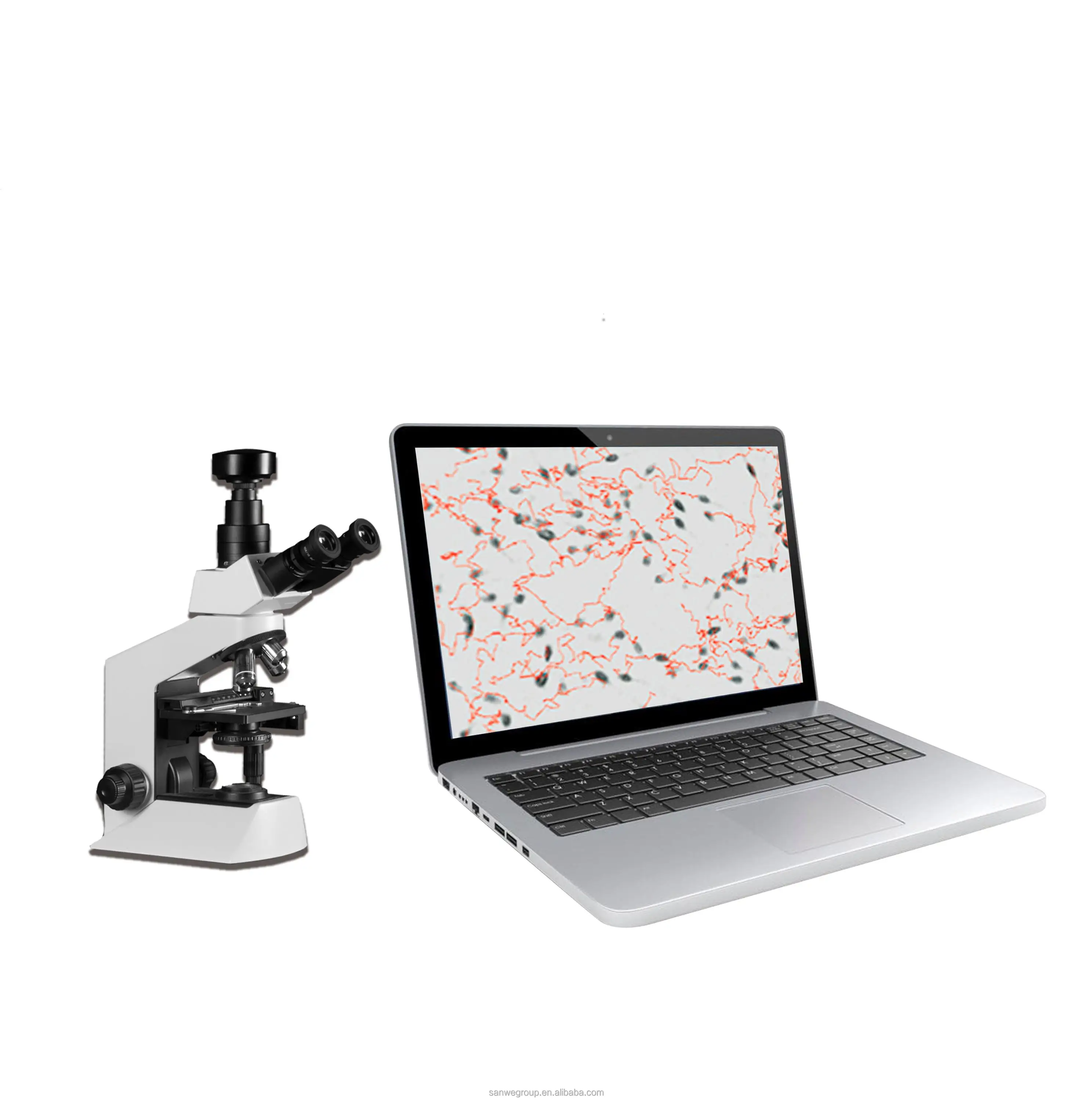 SW-3702  Portable Laptop Semen Analyzer