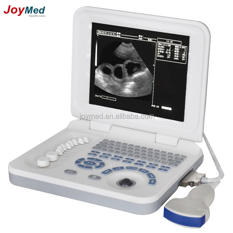 Echo ultrasound scanner 3D Function Laptop/Notebook  Ultrasound machine ecografo portatil