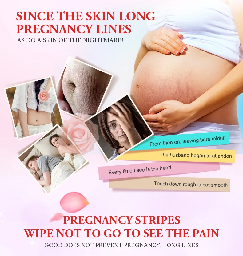 Pretty Cowry Maternity Skin Care Anti Scar Stretch Marks Removal Oil