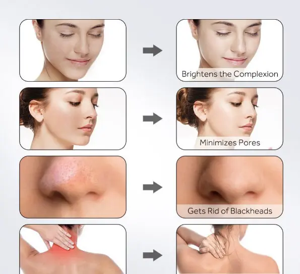 Private Label Skin Care Natural Organic Charcoal Moisturizing Matcha Dead Sea Mud Mask