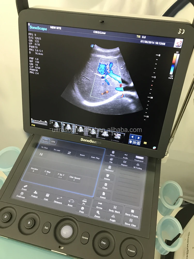 2d portable sonoscape s9 ultrasound machine price/ecografo