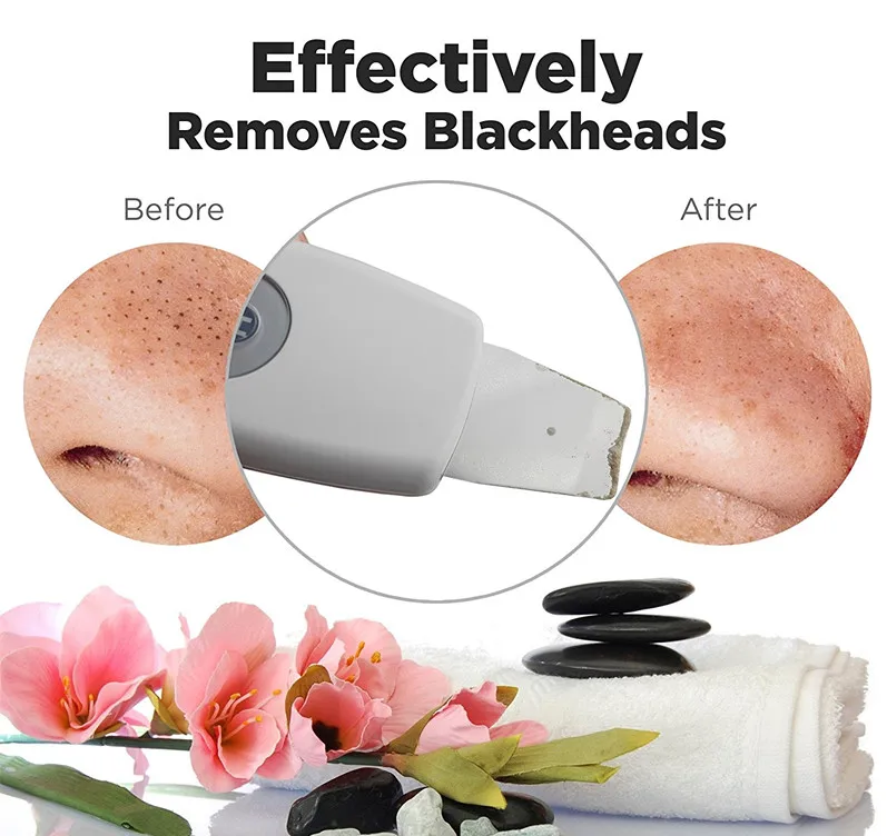 professional sonophoresis ems facial face ultrasonic ion skin scrubber peeling spatula beauty machine portable