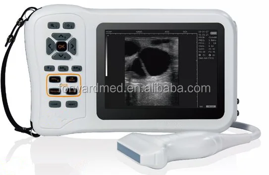 Portable Ultrasonic Diagnostic Devices Type Laptop ultrasound scanner/ usb ultrasound probe for laptop