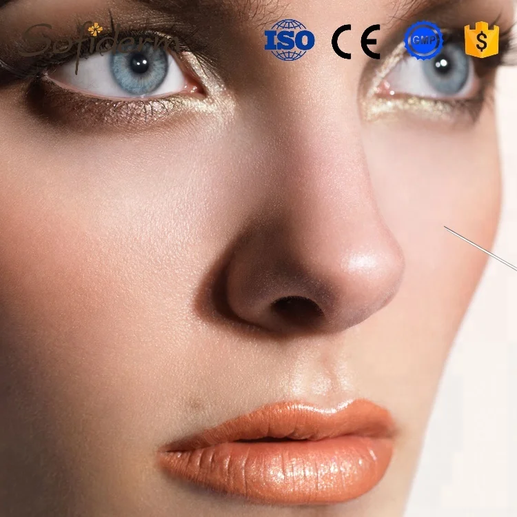 Sofiderm beauty product injectable hyaluronic acid gel filler for anti aging