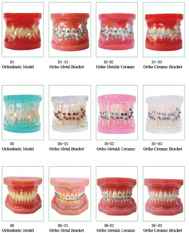 Dental Ortho teeth model