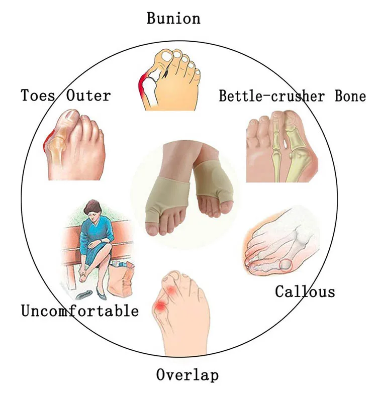 Wholesale Gel Hallux Valgus Bunion Orthosis Corrector for High Heel