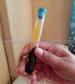 Glass Blood tube ACD-A PRP Activator Anticoagulant and separation gel prp tube for skin care, face v lifting and hair loss etc.