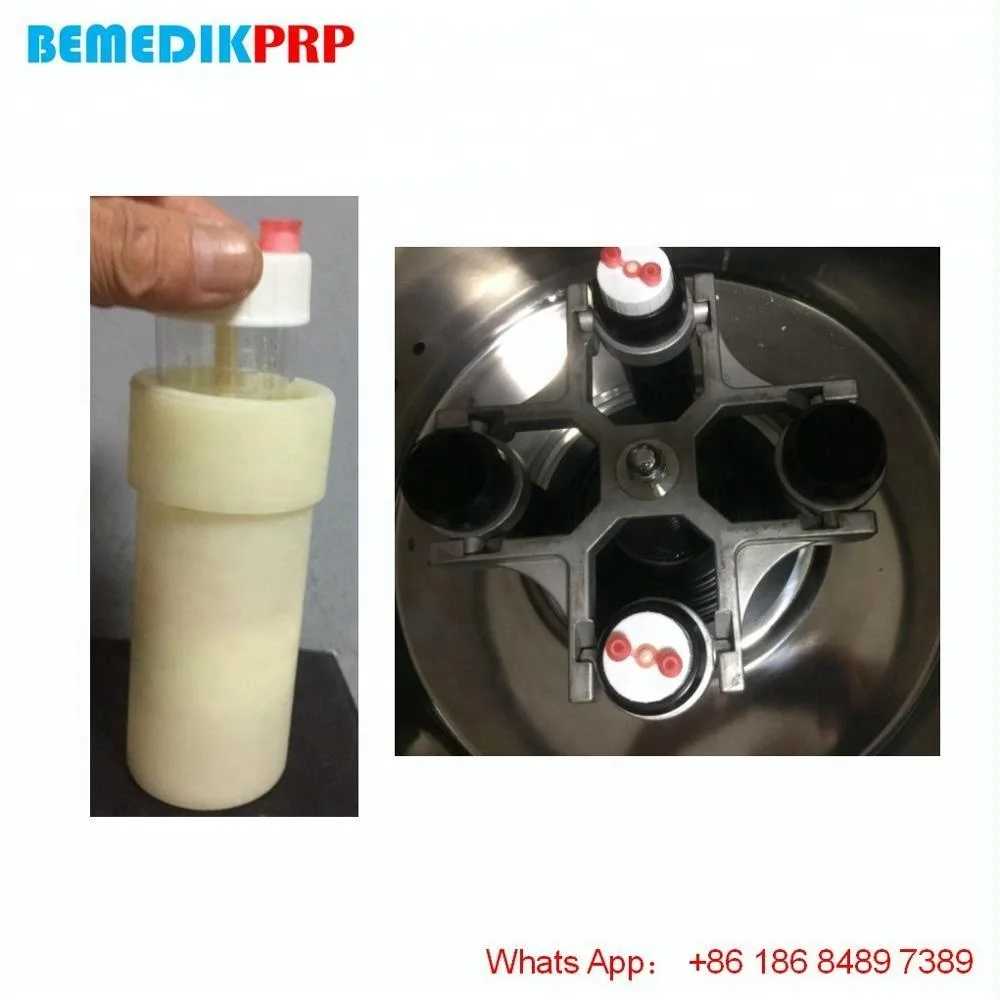 The best prp centrifuge suppliers with ce certification PRP01 4000RPM PRO PRP CENTRIFUGE